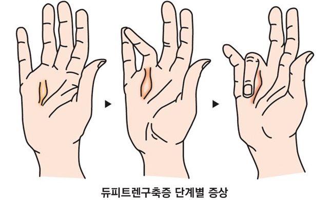 증상