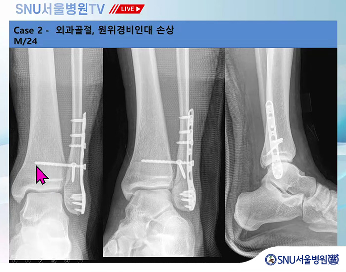 16121c01badc5cb5c03f9e7a1319dd70_1772069516_1577.jpg 16121c01badc5cb5c03f9e7a1319dd70_1772069516_1577.jpg