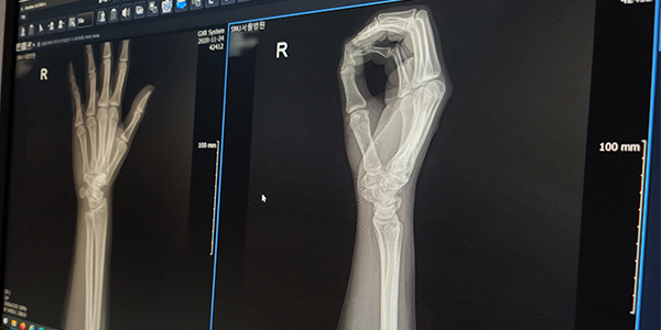 X-ray