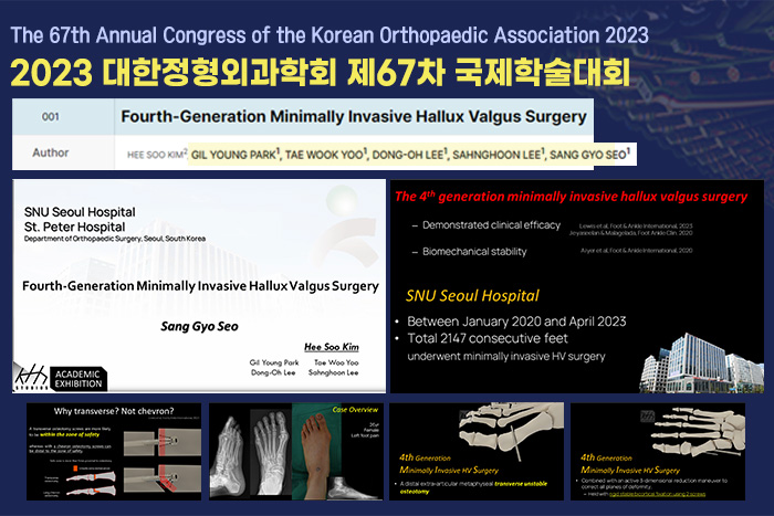 4세대 mita